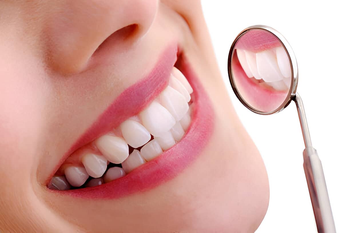 Teeth Whitening in Langley, BC