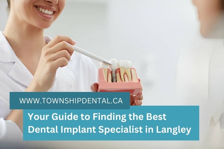Your Guide to Finding the Best Dental Implant Specialist in Langley