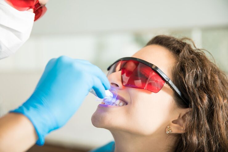 laser whitening in langley