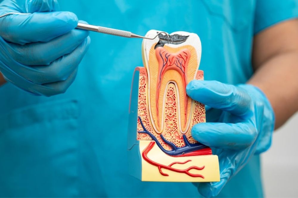Why Root Canal Therapy Is Easier Than You Think